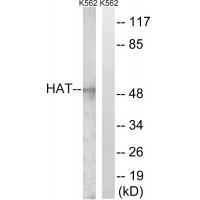 HAT1 Antibody in Western Blot (WB)