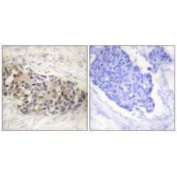 USF2 Antibody in Immunohistochemistry (Paraffin) (IHC (P))