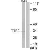 FOXE1 Antibody in Western Blot (WB)