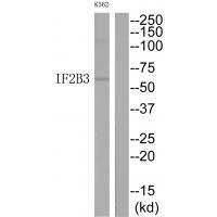 IGF2BP3 Antibody in Western Blot (WB)