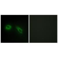 PRKCSH Antibody in Immunocytochemistry (ICC/IF)