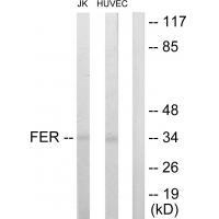 FER Antibody in Western Blot (WB)