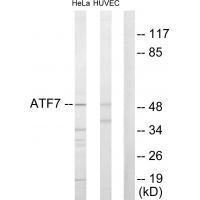 ATF7 Antibody in Western Blot (WB)