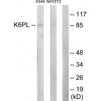 PFKL Antibody in Western Blot (WB)