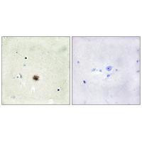CRP1 Antibody in Immunohistochemistry (Paraffin) (IHC (P))
