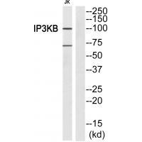 ITPKB Antibody in Western Blot (WB)