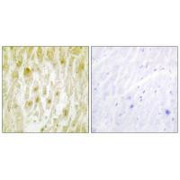 GTF2E2 Antibody in Immunohistochemistry (Paraffin) (IHC (P))