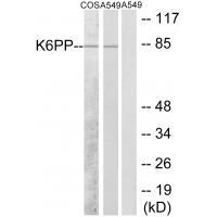 PFKP Antibody in Western Blot (WB)