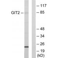 GIT2 Antibody in Western Blot (WB)