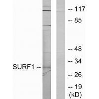 SURF1 Antibody in Western Blot (WB)