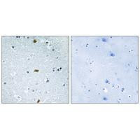 ZFHX3 Antibody in Immunohistochemistry (Paraffin) (IHC (P))