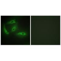 CDKL4 Antibody in Immunocytochemistry (ICC/IF)