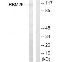 RBM26 Antibody in Western Blot (WB)