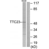 TTC23 Antibody in Western Blot (WB)
