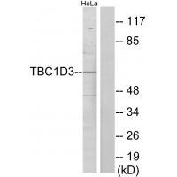 TBC1D3 Antibody in Western Blot (WB)