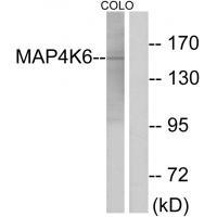 MINK1 Antibody in Western Blot (WB)
