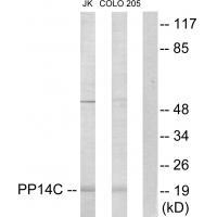 PPP1R14C Antibody in Western Blot (WB)