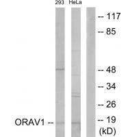 ORAOV1 Antibody in Western Blot (WB)