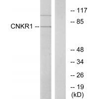 CNKSR1 Antibody in Western Blot (WB)