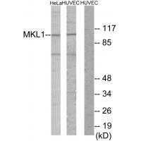 MKL1 Antibody in Western Blot (WB)