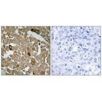 BTBD6 Antibody in Immunohistochemistry (Paraffin) (IHC (P))