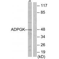 ADPGK Antibody in Western Blot (WB)