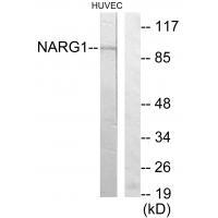NAA15 Antibody in Western Blot (WB)