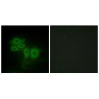 SLK Antibody in Immunocytochemistry (ICC/IF)