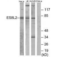 EPS8L2 Antibody in Western Blot (WB)