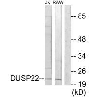 DUSP22 Antibody in Western Blot (WB)