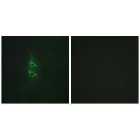 MRC2 Antibody in Immunocytochemistry (ICC/IF)