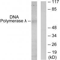 POLL Antibody in Western Blot (WB)