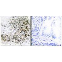 TRPS1 Antibody in Immunohistochemistry (Paraffin) (IHC (P))