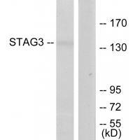 STAG3 Antibody in Western Blot (WB)