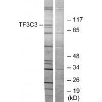 GTF3C3 Antibody in Western Blot (WB)