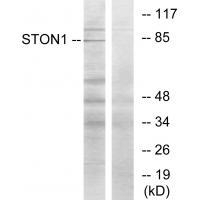 SALF Antibody in Western Blot (WB)