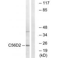 CYB561D2 Antibody in Western Blot (WB)