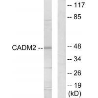 CADM2 Antibody in Western Blot (WB)