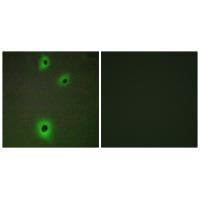 CADM4 Antibody in Immunocytochemistry (ICC/IF)
