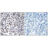 DCL-1 Antibody in Immunohistochemistry (Paraffin) (IHC (P))