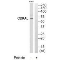 CDKAL1 Antibody in Western Blot (WB)