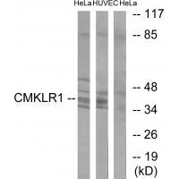 CMKLR1 Antibody in Western Blot (WB)