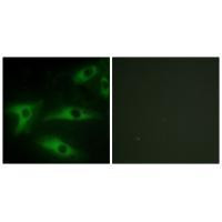 COL1A2 Antibody in Immunocytochemistry (ICC/IF)