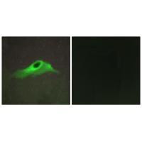 COL4A5 Antibody in Immunocytochemistry (ICC/IF)