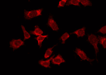 COL14A1 Antibody in Immunocytochemistry (ICC/IF)