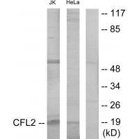 Cofilin 2 Antibody in Western Blot (WB)