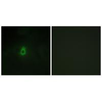 CYP2E1 Antibody in Immunocytochemistry (ICC/IF)