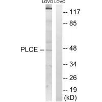 AGPAT5 Antibody in Western Blot (WB)