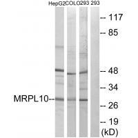 MRPL10 Antibody in Western Blot (WB)