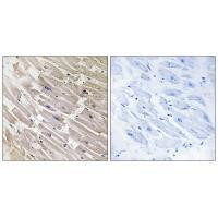 MRPL16 Antibody in Immunohistochemistry (Paraffin) (IHC (P))